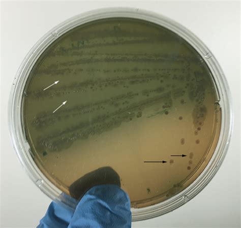 p aeruginosa on macconkey agar|12.6.1: MacConkey Agar .